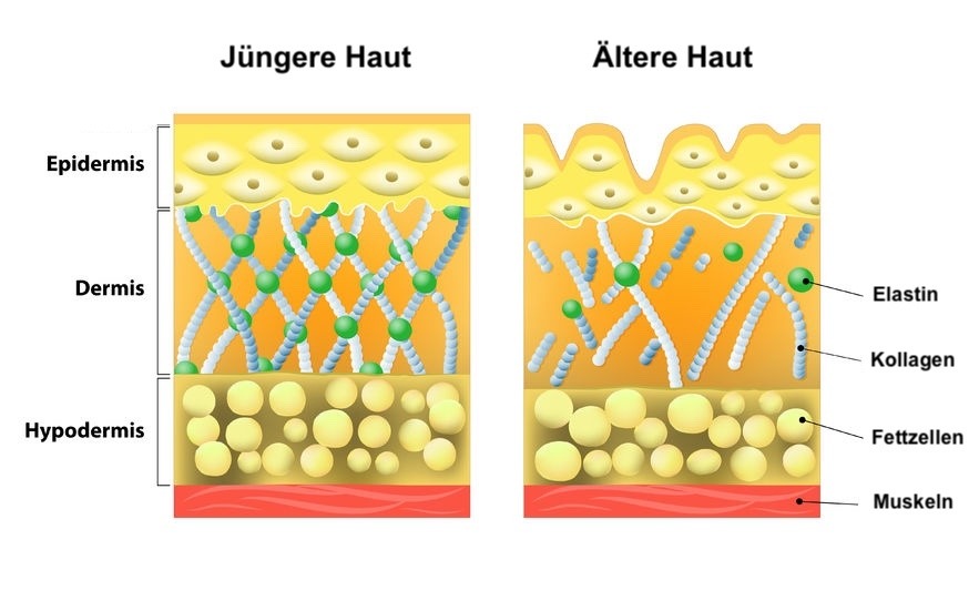 Hautalterung
